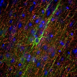 NF-M Antibody (3H11), Novus Biologicals 0.05mL; Unlabeled:Antibodies, Monoclonal