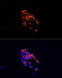 NF-M Rabbit anti-Human, Clone: 5E0D2, Novus Biologicals:Antibodies:Primary