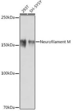 NF-M Rabbit anti-Human, Clone: 5E0D2, Novus Biologicals:Antibodies:Primary