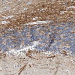 NF-M Antibody, Novus Biologicals 25 &mu;L; Unlabeled:Antibodies, Polyclonal