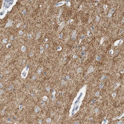 NF-M Antibody, Novus Biologicals 25 &mu;L; Unlabeled:Antibodies, Polyclonal