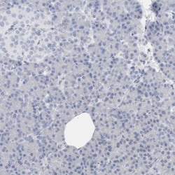 NF-M Antibody, Novus Biologicals 25 &mu;L; Unlabeled:Antibodies, Polyclonal