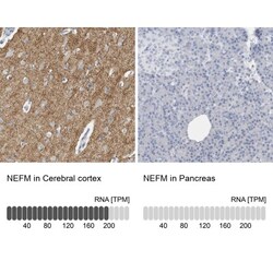 NF-M Antibody, Novus Biologicals 25 &mu;L; Unlabeled:Antibodies, Polyclonal