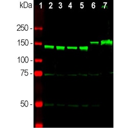 NF-M Antibody, Novus Biologicals 0.1mL; Unlabeled:Antibodies, Polyclonal