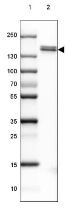 NF-M Antibody, Novus Biologicals 25 &mu;L; Unlabeled:Antibodies, Polyclonal