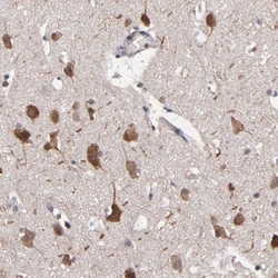 NF2/Merlin Antibody, Novus Biologicals:Antibodies:Primary Antibodies