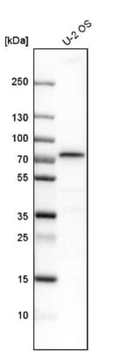 NF2/Merlin Antibody, Novus Biologicals:Antibodies:Primary Antibodies
