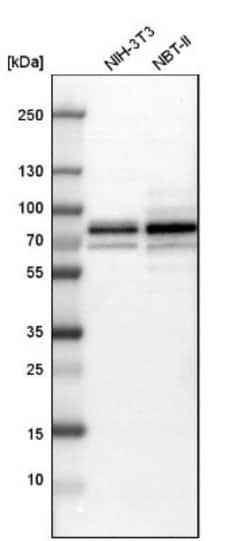 NF2/Merlin Antibody, Novus Biologicals:Antibodies:Primary Antibodies