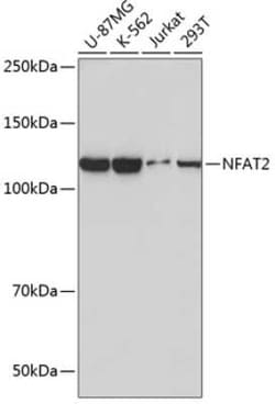NFATC1/NFAT2 Rabbit anti-Human, Clone: 4I9P10, Novus Biologicals:Antibodies:Primary
