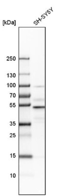 NFIB Antibody, Novus Biologicals 0.1mL; Unlabeled:Antibodies, Polyclonal