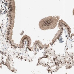 NFRKB Antibody, Novus Biologicals:Antibodies:Primary Antibodies