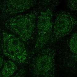NFS1 Antibody, Novus Biologicals 25 &mu;L, Unlabeled:Antibodies, Polyclonal