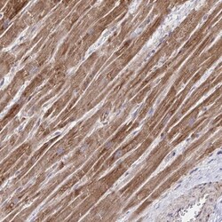 NFS1 Antibody, Novus Biologicals 25 &mu;L, Unlabeled:Antibodies, Polyclonal