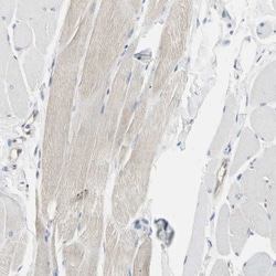 NFkB2/NFkB p100 Antibody, Novus Biologicals 0.1mL; Unlabeled:Antibodies,
