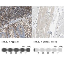 NFkB2/NFkB p100 Antibody, Novus Biologicals 0.1mL; Unlabeled:Antibodies,