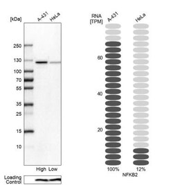 NFkB2/NFkB p100 Antibody, Novus Biologicals 0.1mL; Unlabeled:Antibodies,
