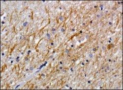 NG2/MCSP Antibody (LHM 2), Novus Biologicals 0.1mL; Unlabeled:Antibodies,