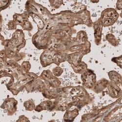 NG2/MCSP Antibody, Novus Biologicals 0.1mL; Unlabeled:Antibodies, Polyclonal
