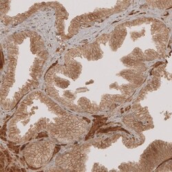 NG2/MCSP Antibody, Novus Biologicals 0.1mL; Unlabeled:Antibodies, Polyclonal