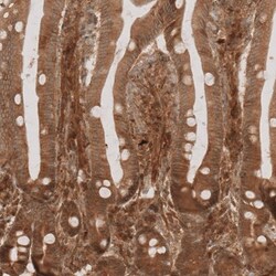 NG2/MCSP Antibody, Novus Biologicals 0.1mL; Unlabeled:Antibodies, Polyclonal