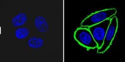 NGFR/TNFRSF16/p75NTR Antibody (NGFR5), Novus Biologicals 0.2mg; Unlabeled:Antibodies,