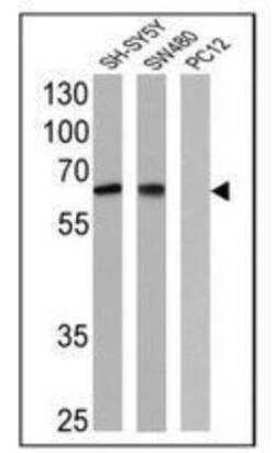 NGFR/TNFRSF16/p75NTR Antibody (NGFR5), Novus Biologicals 0.2mg; Unlabeled:Antibodies,