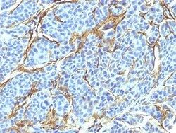 NGFR/TNFRSF16/p75NTR Antibody (NTR/912), Novus Biologicals 0.2mg; Unlabeled:Antibodies,