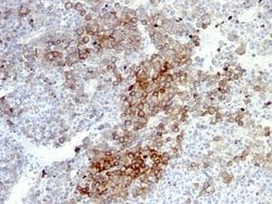 NGFR/TNFRSF16/p75NTR Antibody (NGFR5 + NTR/912), Novus Biologicals 0.2mg;