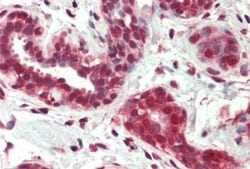 NGFI-B alpha/Nur77/NR4A1 Antibody, Novus Biologicals 0.1 mg | Buy Online | Novus Biologicals | Fisher Scientific