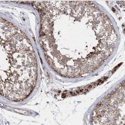 NGLY1 Antibody, Novus Biologicals 25 &mu;L | Buy Online | Novus Biologicals | Fisher Scientific