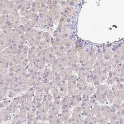 NHE1/SLC9A1 Antibody, Novus Biologicals 0.1mL; Unlabeled:Antibodies, Polyclonal