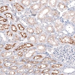 NHE3/SLC9A3 Antibody, Novus Biologicals 25 &mu;L | Buy Online | Novus Biologicals (Bio-Techne) | Fisher Scientific