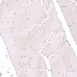 NHE3/SLC9A3 Antibody, Novus Biologicals 25 &mu;L | Buy Online | Novus Biologicals (Bio-Techne) | Fisher Scientific