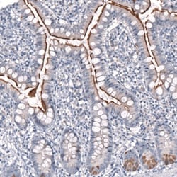 NHE3/SLC9A3 Antibody, Novus Biologicals 25 &mu;L | Buy Online | Novus Biologicals (Bio-Techne) | Fisher Scientific