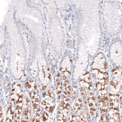 NHE3/SLC9A3 Antibody, Novus Biologicals 25 &mu;L | Buy Online | Novus Biologicals (Bio-Techne) | Fisher Scientific