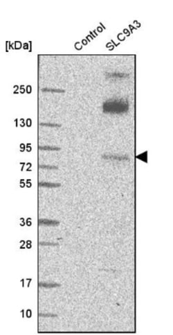 NHE3/SLC9A3 Antibody, Novus Biologicals 25 &mu;L | Buy Online | Novus Biologicals (Bio-Techne) | Fisher Scientific