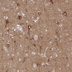 NHE6/SLC9A6 Antibody, Novus Biologicals 0.1mL; Unlabeled:Antibodies, Polyclonal