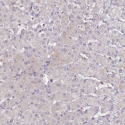 NHE6/SLC9A6 Antibody, Novus Biologicals 0.1mL; Unlabeled:Antibodies, Polyclonal