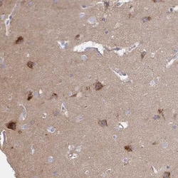 NHE6/SLC9A6 Antibody, Novus Biologicals 25 &mu;L, Unlabeled:Antibodies,