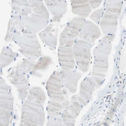 NHERF-1 Antibody, Novus Biologicals:Antibodies:Primary Antibodies