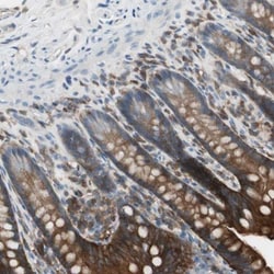 NHERF-1 Antibody, Novus Biologicals:Antibodies:Primary Antibodies