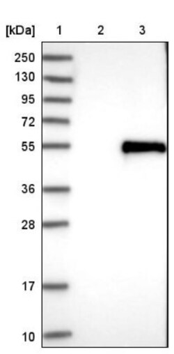 NHERF-1 Antibody, Novus Biologicals:Antibodies:Primary Antibodies