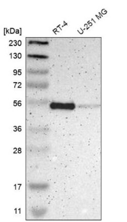 NHERF-1 Antibody, Novus Biologicals:Antibodies:Primary Antibodies
