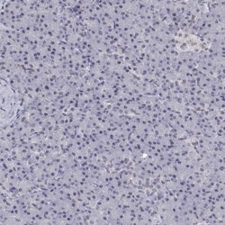 NHP2 Antibody, Novus Biologicals 0.1mL; Unlabeled:Antibodies, Polyclonal