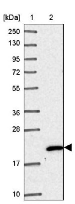 NHP2 Antibody, Novus Biologicals 0.1mL; Unlabeled:Antibodies, Polyclonal