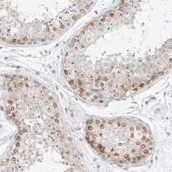 NHSL1 Antibody, Novus Biologicals 0.1mL; Unlabeled:Antibodies, Polyclonal