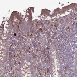 NHSL2 Antibody, Novus Biologicals 0.1mL; Unlabeled:Antibodies, Polyclonal