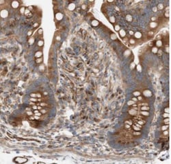 NICE-3 Antibody, Novus Biologicals:Antibodies:Primary Antibodies