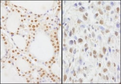 NIF1 Antibody, Novus Biologicals 0.1mg; Unlabeled:Antibodies, Polyclonal