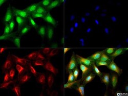 NIK/MAP3K14 Antibody - BSA Free, Novus Biologicals 0.1mL:Antibodies, Polyclonal